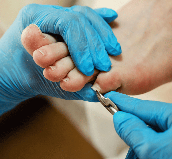 Diabetic Foot Assessment